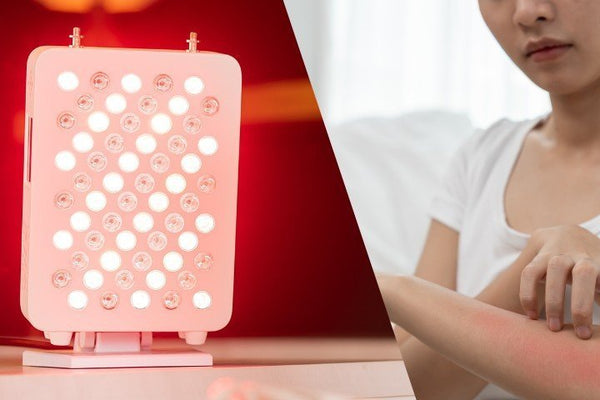Klein rood licht therapie paneel naast een onderarm met rode, geïrriteerde huid